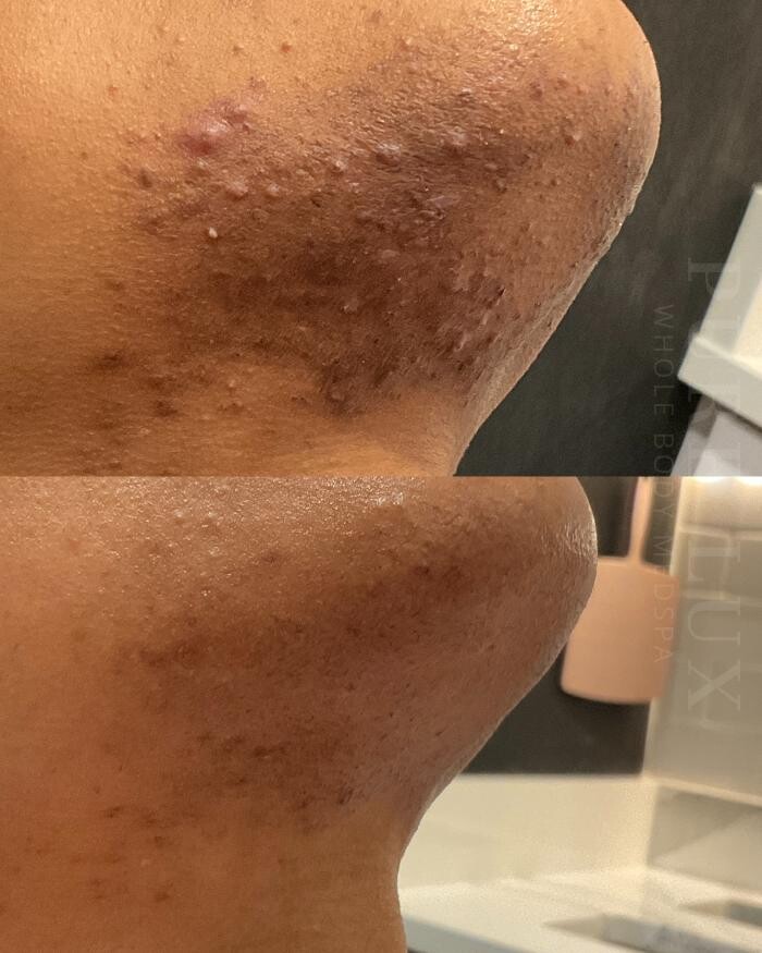 Images Pure Lux Medspa
