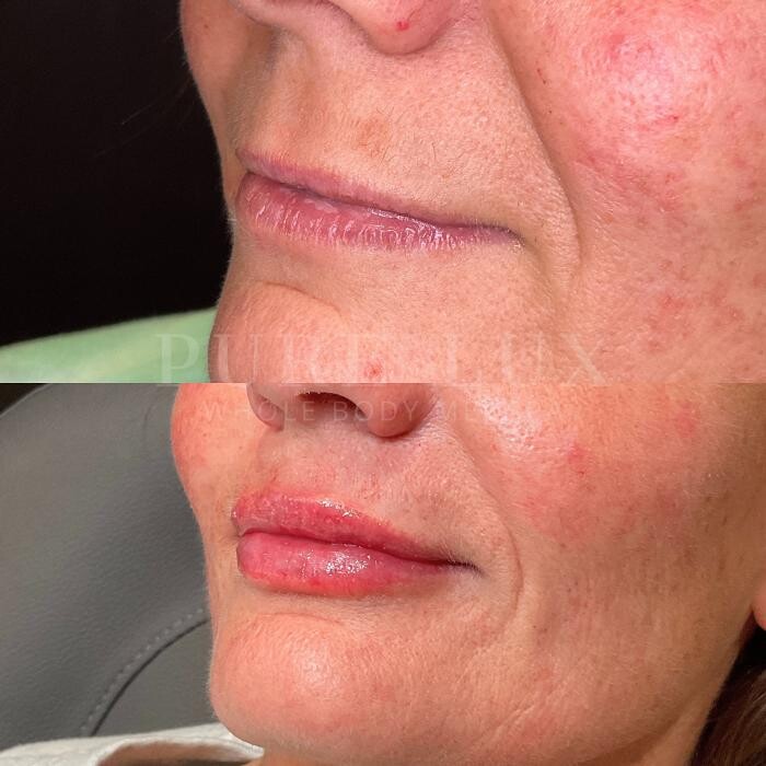 Images Pure Lux Medspa
