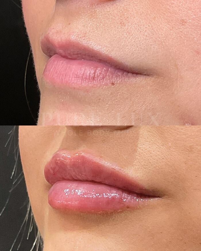 Images Pure Lux Medspa