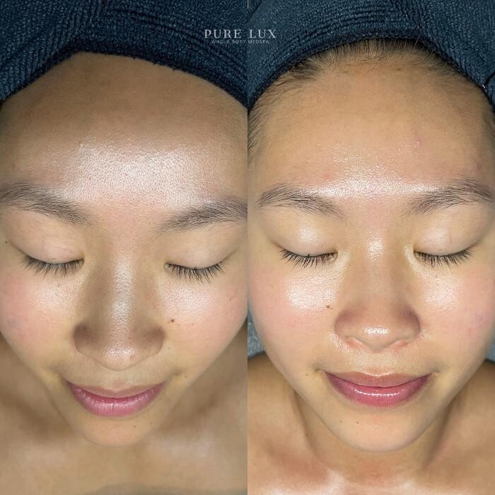 Images Pure Lux Medspa