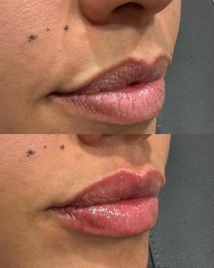 Images Pure Lux Medspa