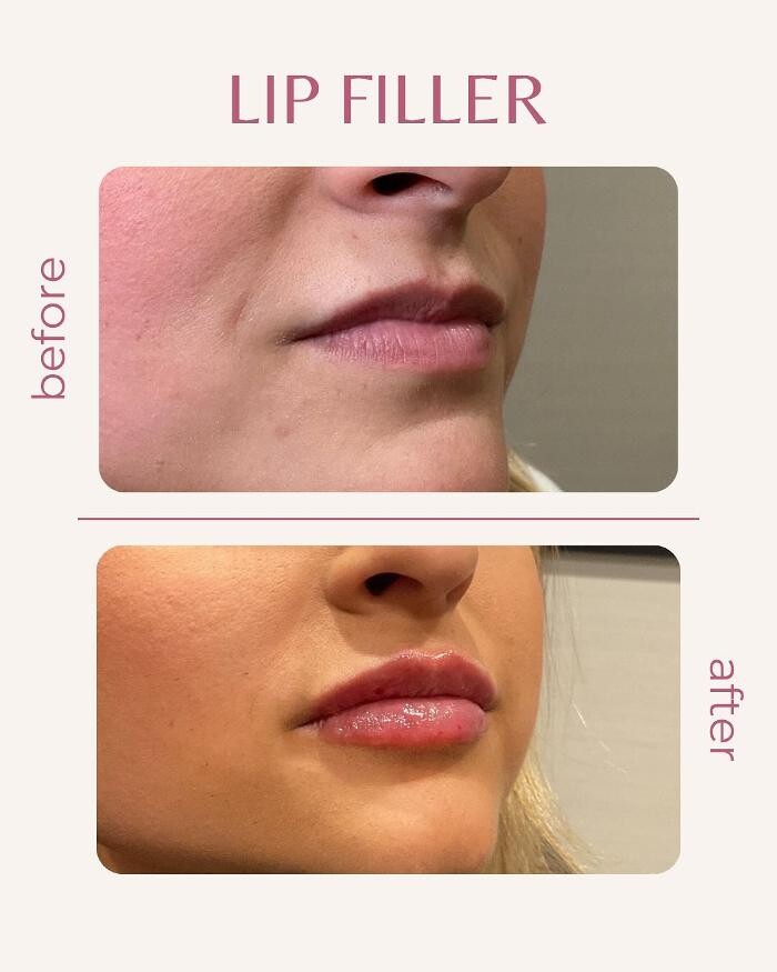 Images Pure Lux Medspa