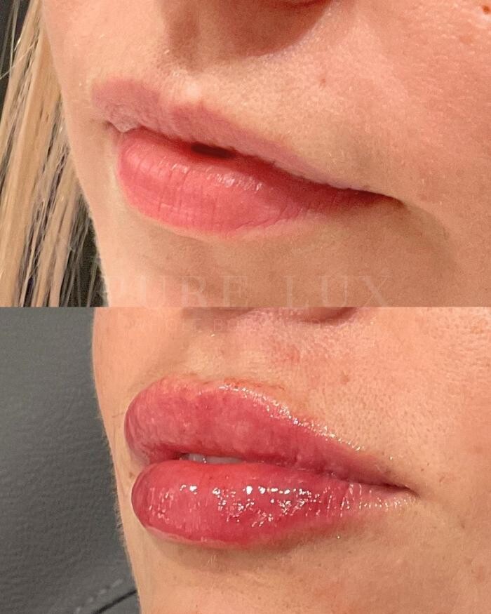 Images Pure Lux Medspa