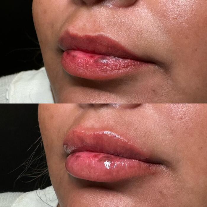 Images Pure Lux Medspa