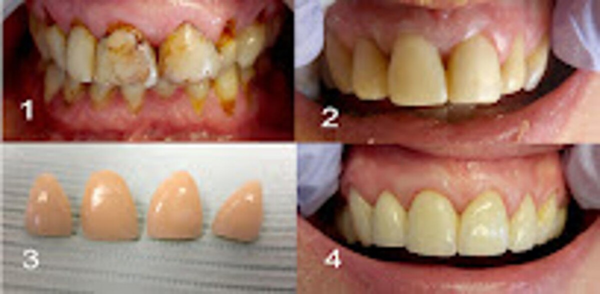 Images Stanley Weiss, DDS & Emanuel Tennenbaum, DDS