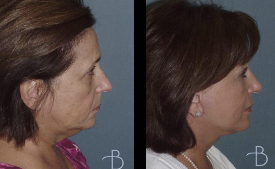 Images Agata Brys, MD Facial Plastic Surgery