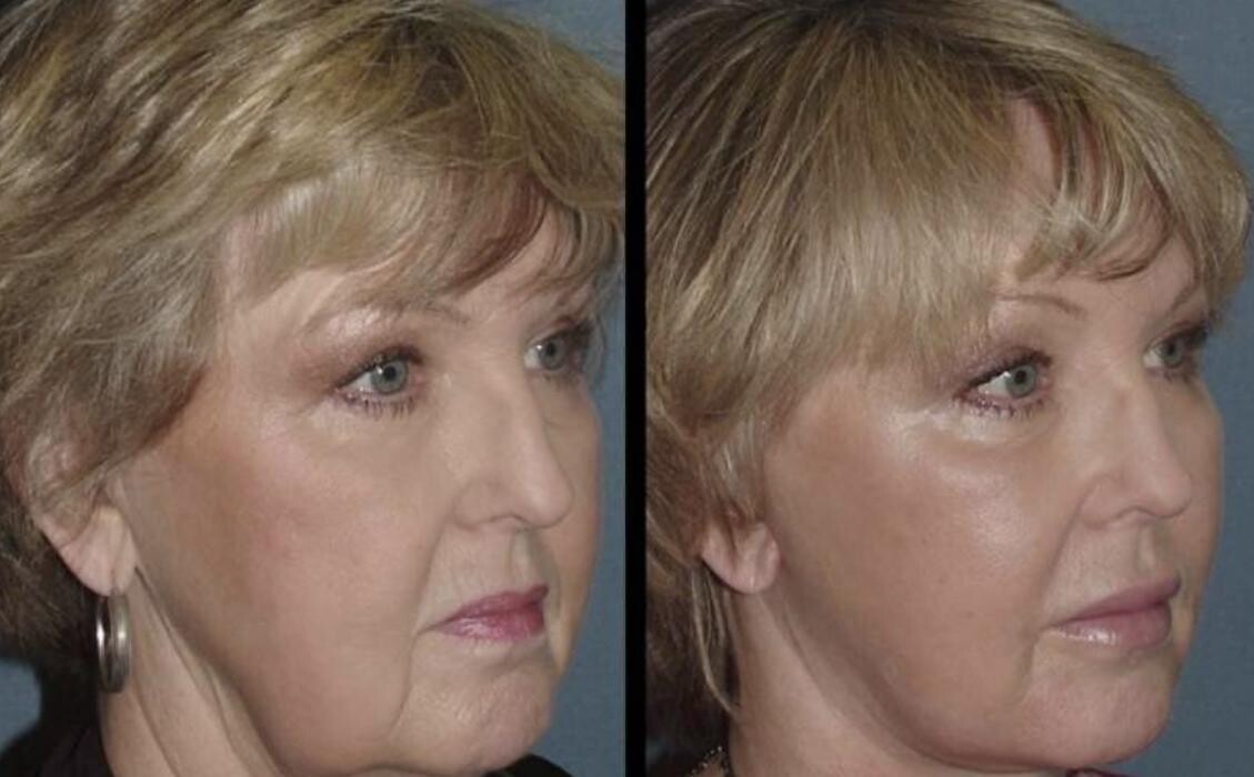 Images Agata Brys, MD Facial Plastic Surgery