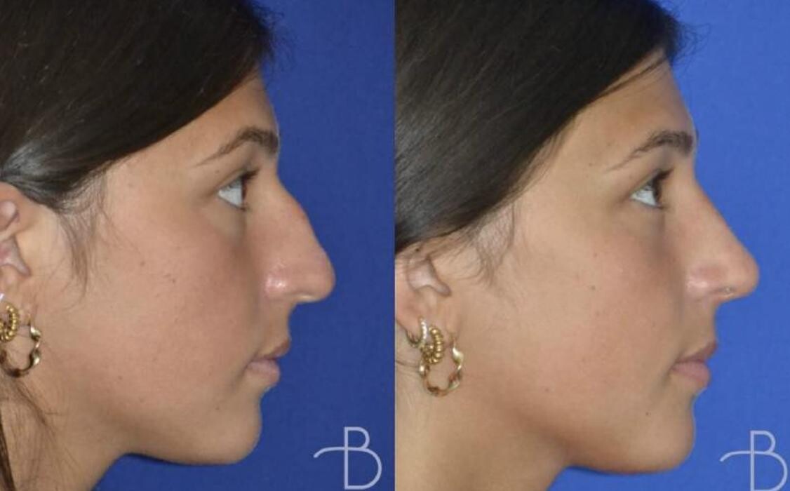 Images Agata Brys, MD Facial Plastic Surgery