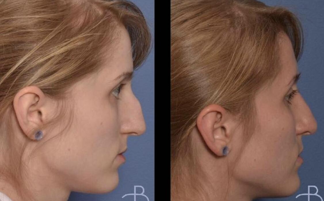 Images Agata Brys, MD Facial Plastic Surgery