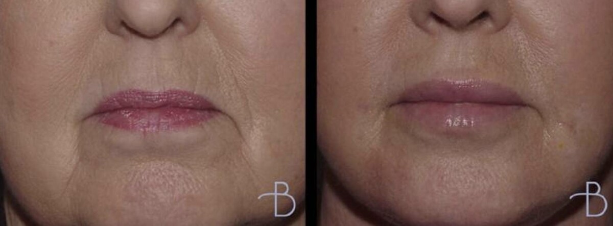 Images Agata Brys, MD Facial Plastic Surgery