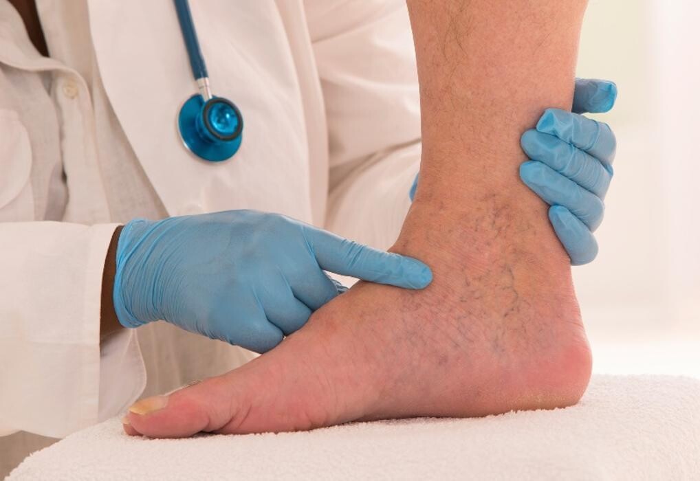 Images California Vein & Vascular Centers