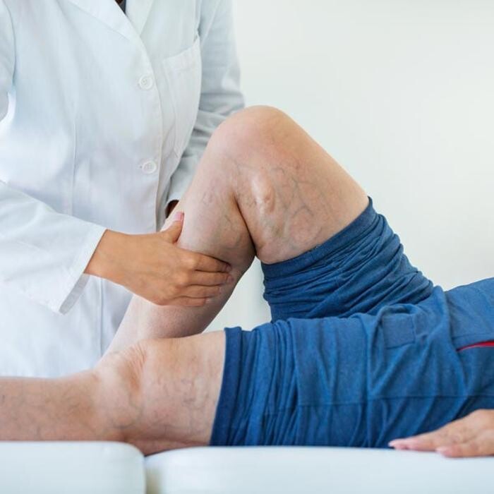 Images California Vein & Vascular Centers