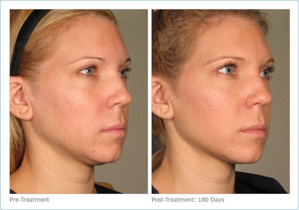 Images New Radiance Cosmetic Centers
