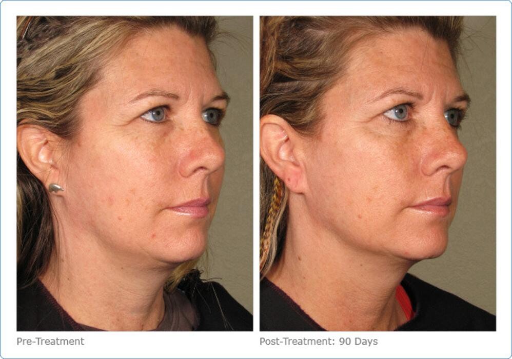 Images New Radiance Cosmetic Centers