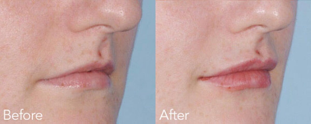Images New Radiance Cosmetic Centers