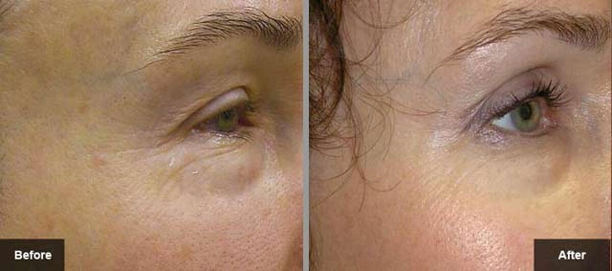 Images New Radiance Cosmetic Centers