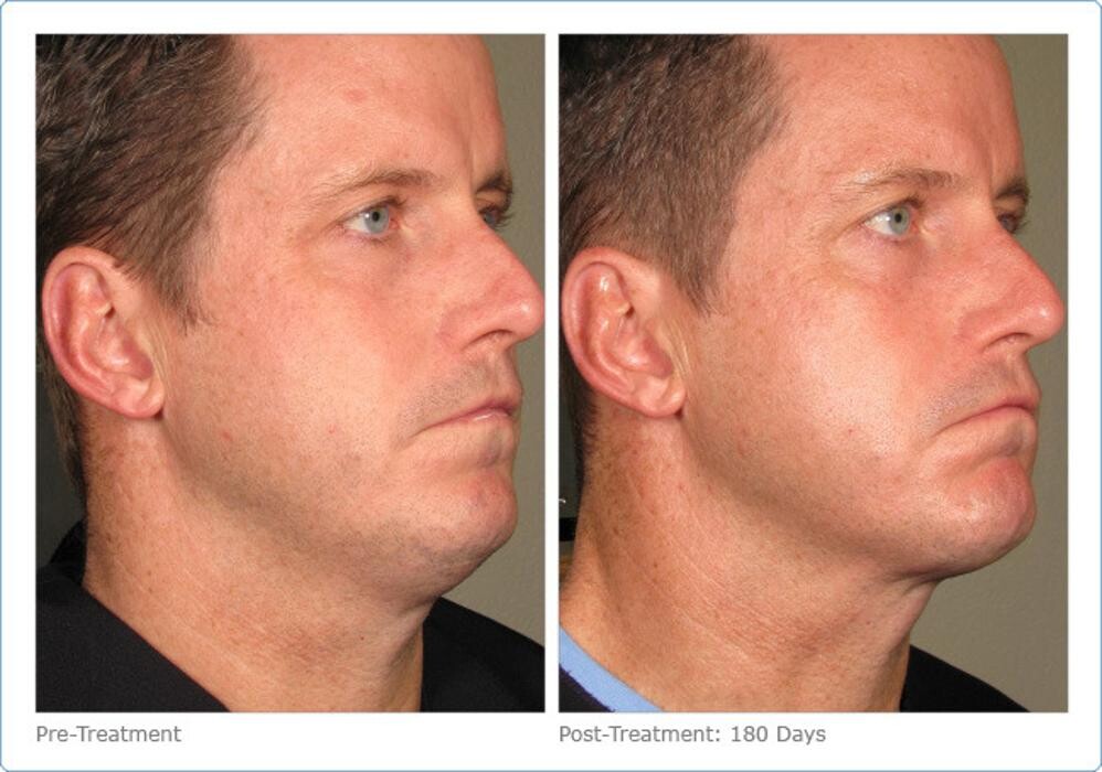 Images New Radiance Cosmetic Centers
