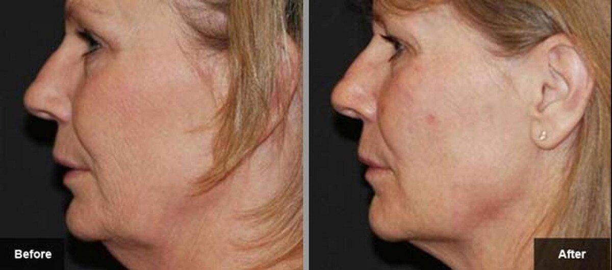 Images New Radiance Cosmetic Centers