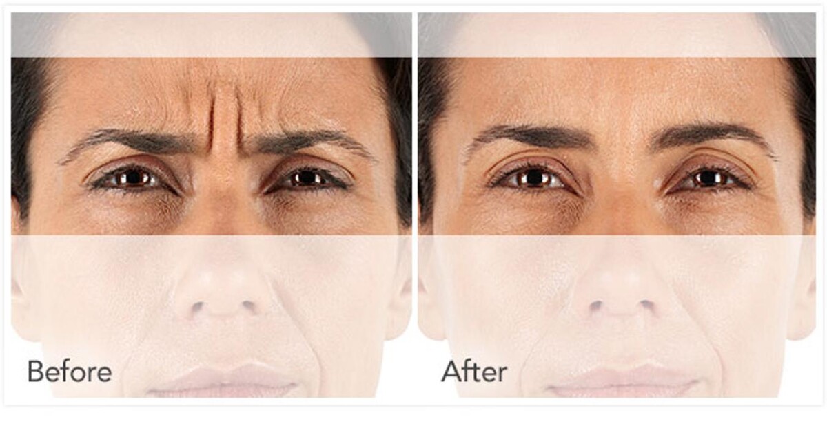 Images New Radiance Cosmetic Centers