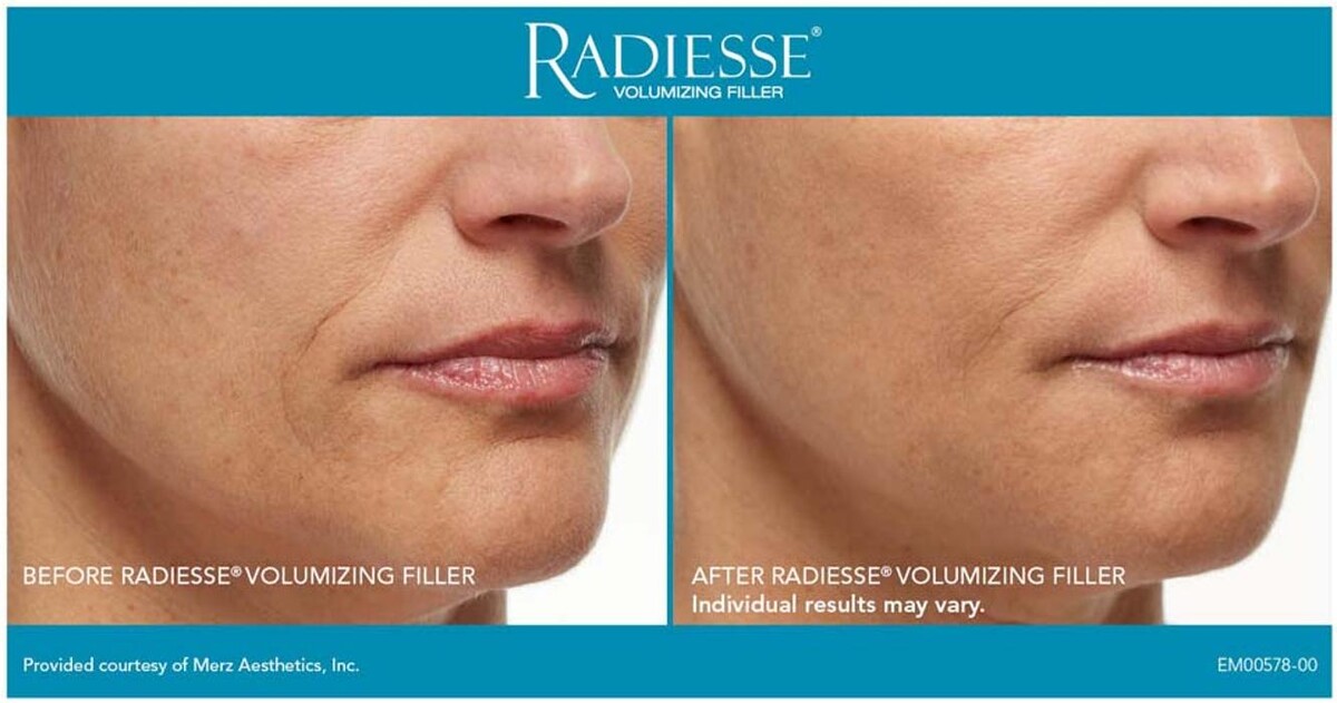 Images New Radiance Cosmetic Centers
