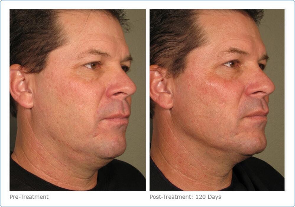 Images New Radiance Cosmetic Centers
