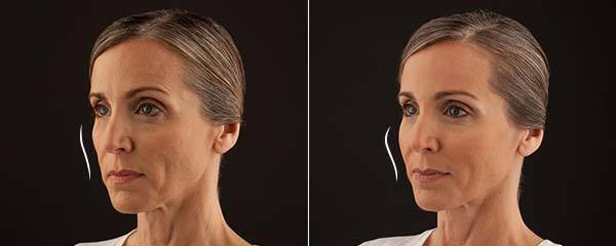 Images New Radiance Cosmetic Centers