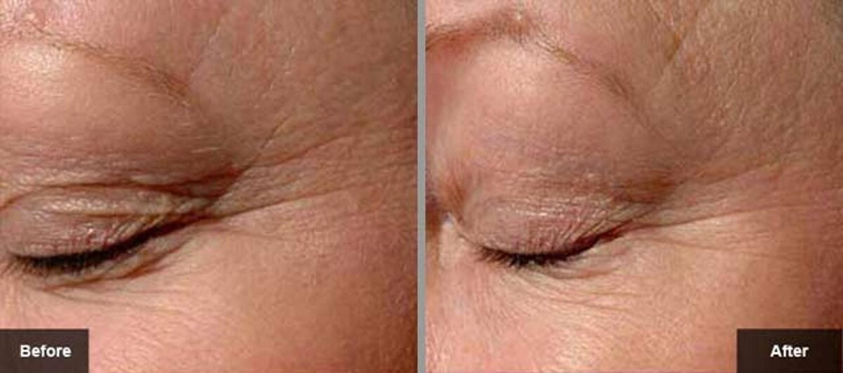 Images New Radiance Cosmetic Centers