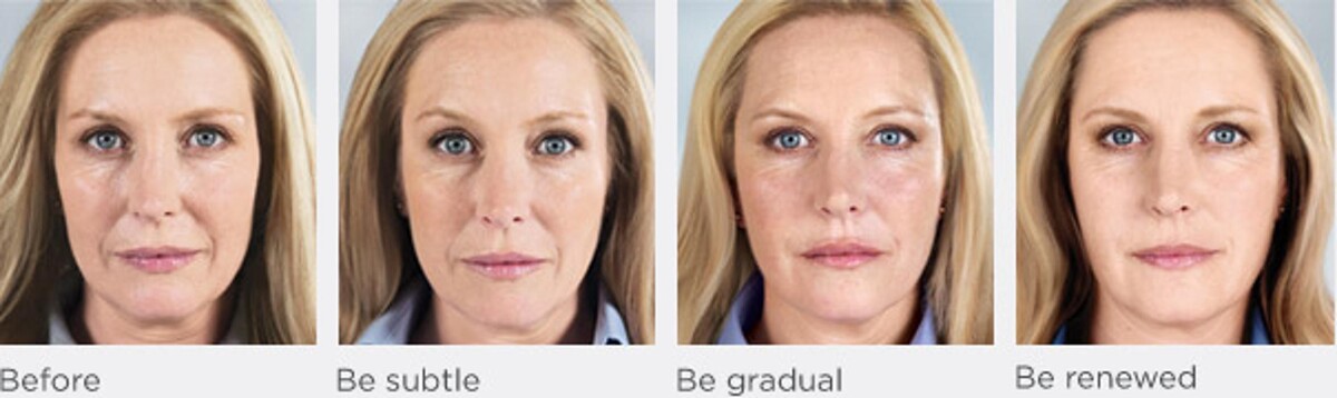 Images New Radiance Cosmetic Centers