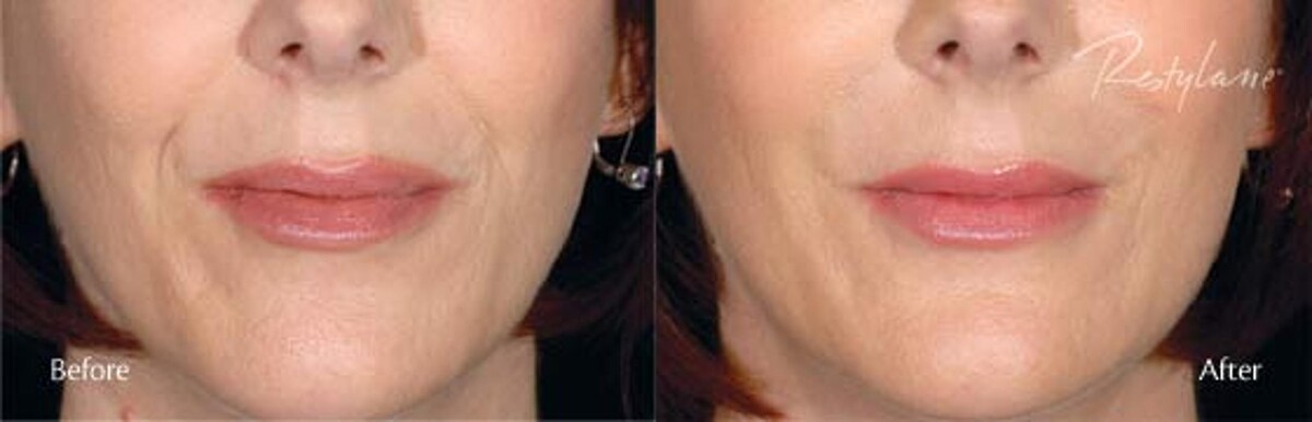 Images New Radiance Cosmetic Centers