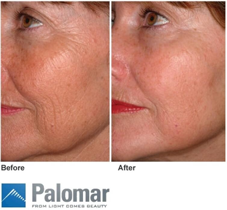 Images New Radiance Cosmetic Centers