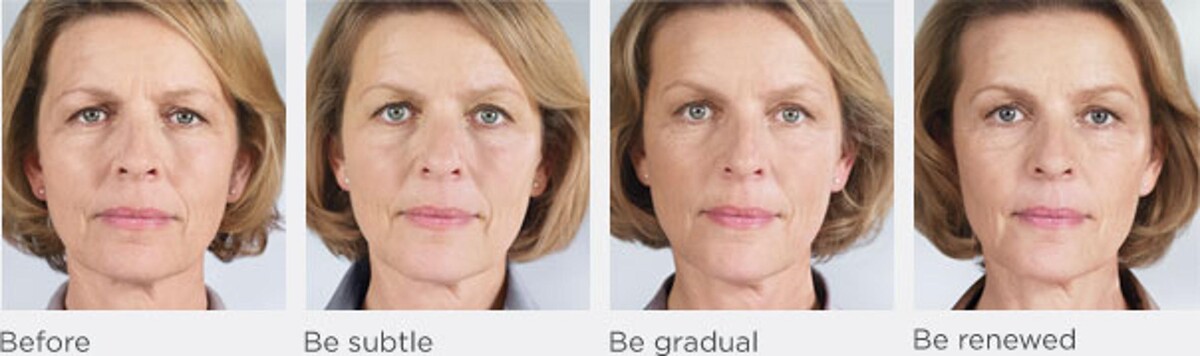 Images New Radiance Cosmetic Centers
