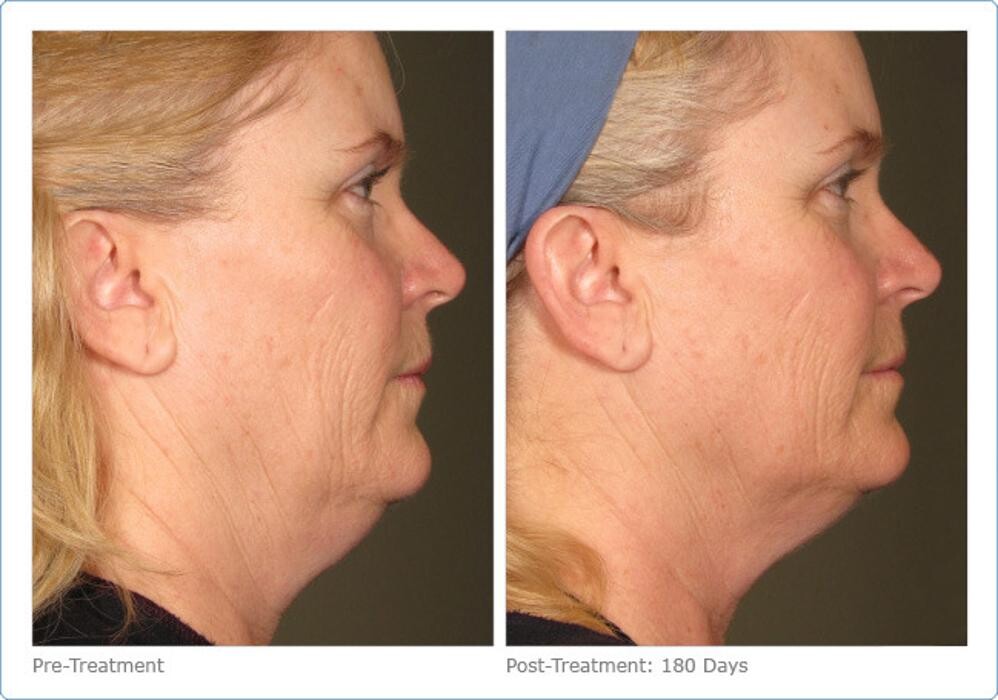 Images New Radiance Cosmetic Centers