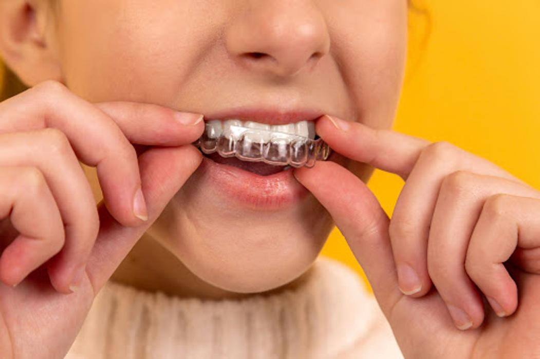 Images Alpine Dental Health - Boulder