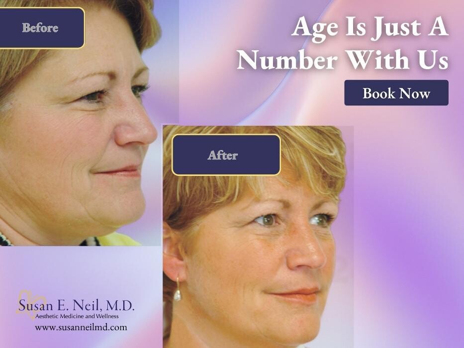 Images Susan E Neil, MD, PSC