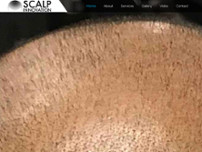 Scalp Innovations website screenshot
