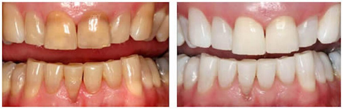 Images Aria Dental of Annapolis