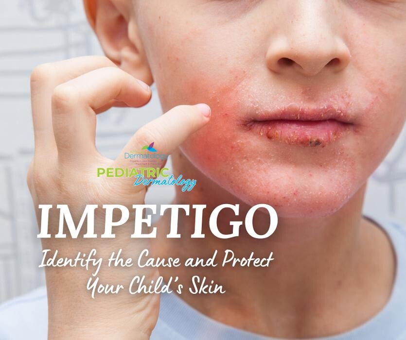 Images Affiliated Dermatology Surprise