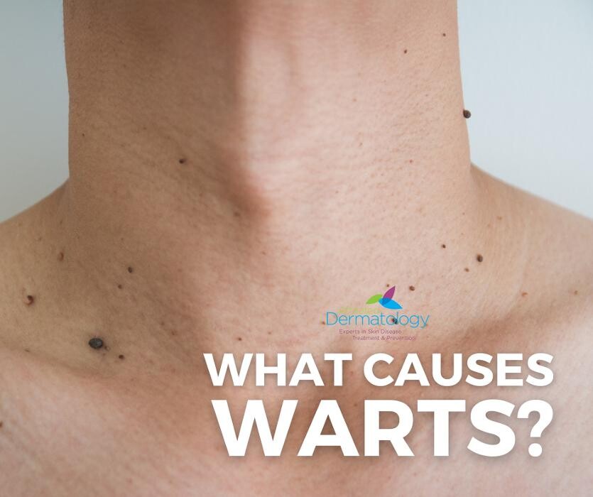 Images Affiliated Dermatology Surprise