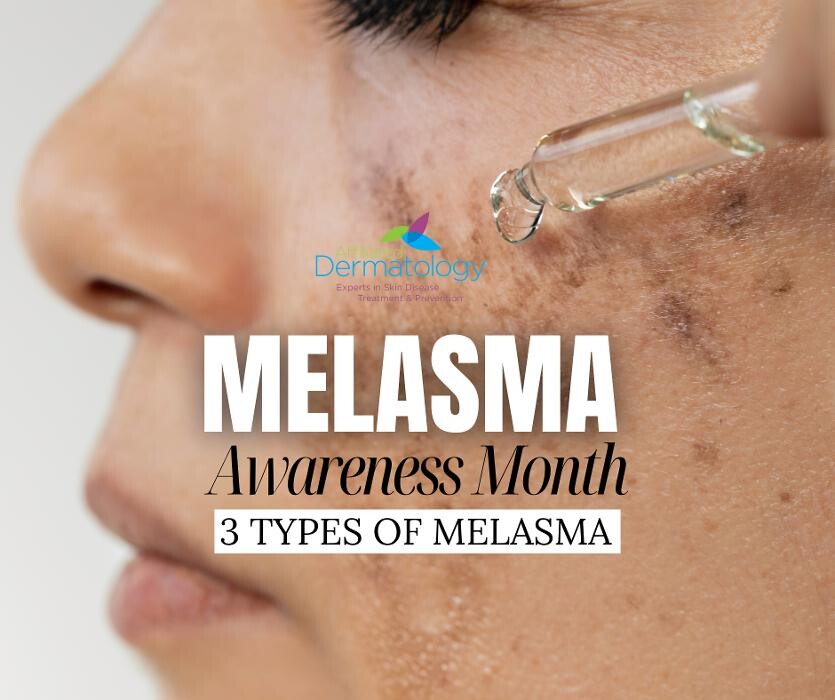 Images Affiliated Dermatology Surprise