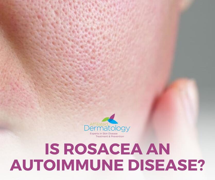 Images Affiliated Dermatology Surprise