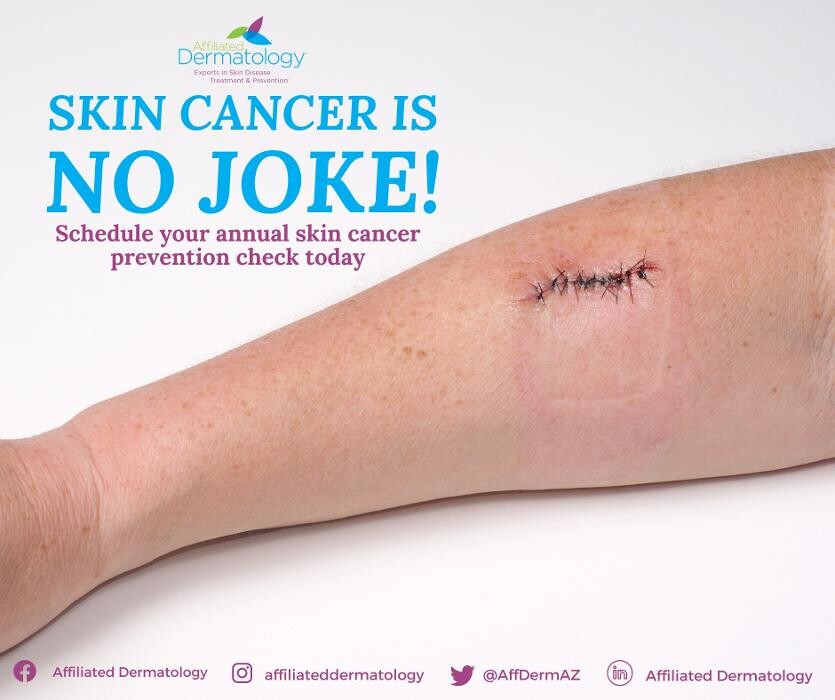 Images Affiliated Dermatology Surprise