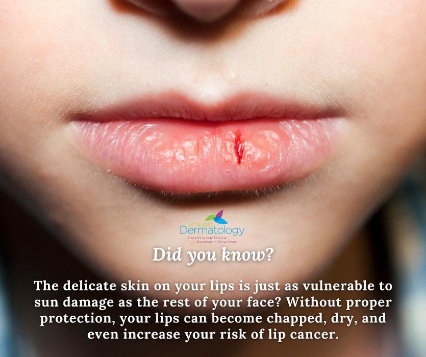 Images Affiliated Dermatology Surprise