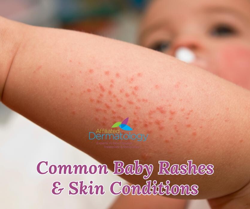 Images Affiliated Dermatology Surprise