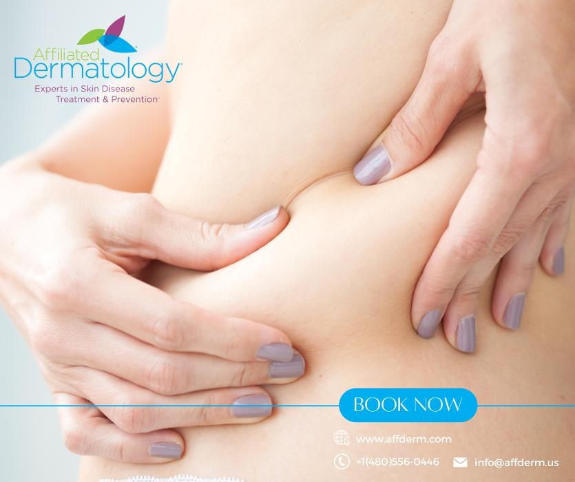 Images Affiliated Dermatology Surprise