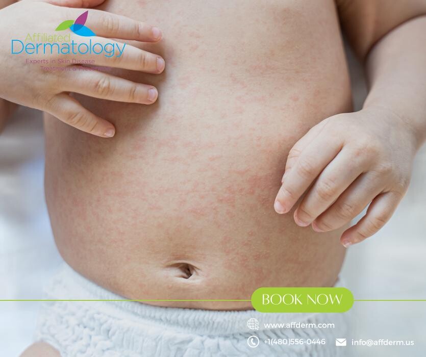 Images Affiliated Dermatology Scottsdale