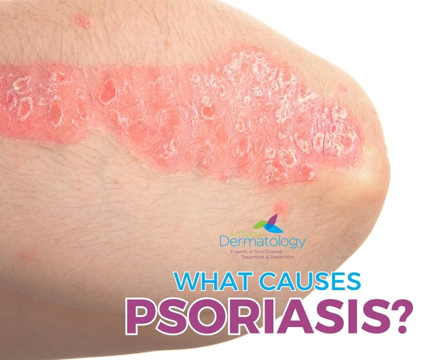 Images Affiliated Dermatology Scottsdale