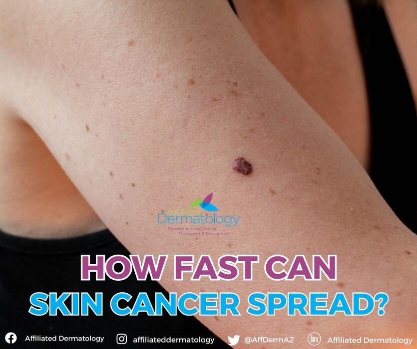 Images Affiliated Dermatology Scottsdale