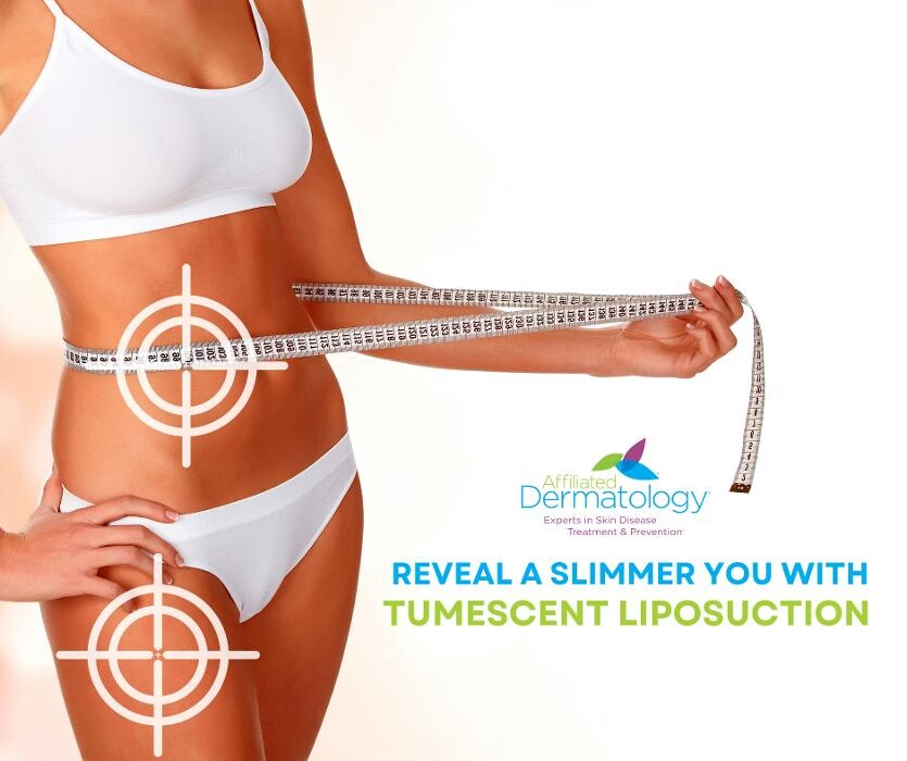 Images Affiliated Dermatology Scottsdale