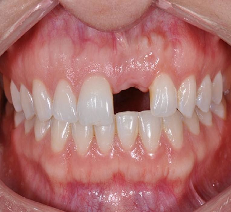 Images South Jersey Periodontics & Dental Implants, LLC
