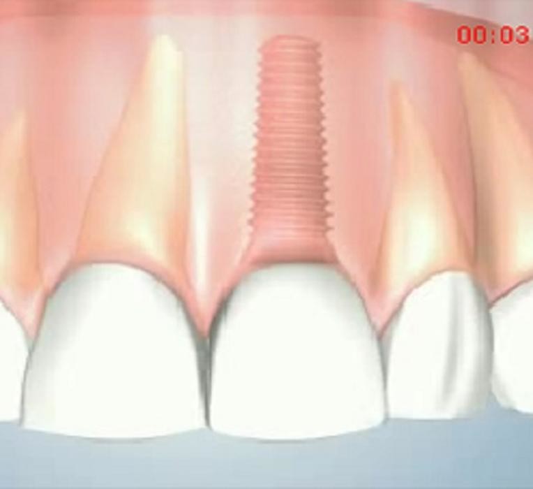 Images South Jersey Periodontics & Dental Implants, LLC